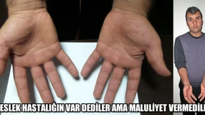 Meslek Hastası Diye İşine Son Verdiler fakat....