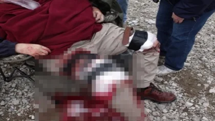 İnşaat'ta Spiral Motoru ile Bacağını Kesti